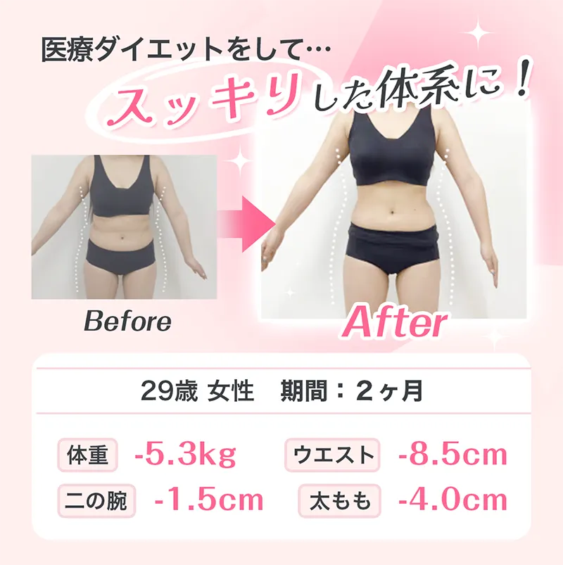 医療ダイエットをして…すっきりした体系に！