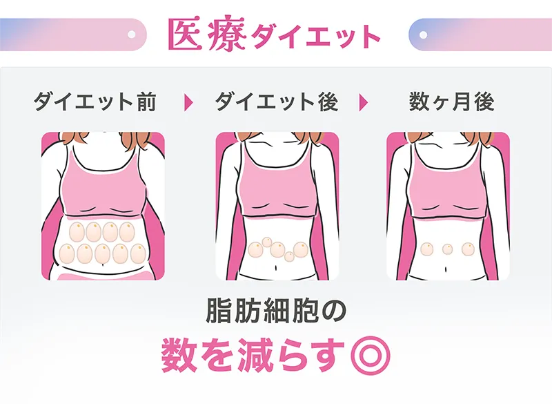 医療ダイエット　脂肪細胞の数を減らす